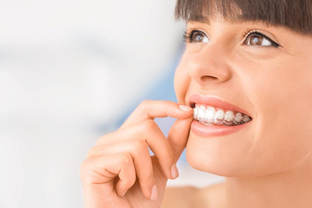 INVISALIGN